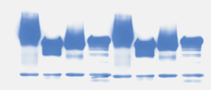 Introducción a Western Blot